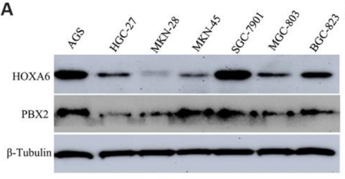 Western blot analysis of HOXA6 and PBX2.jpg